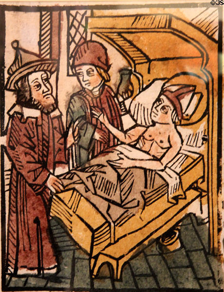 Blood-letting graphic (1438-40) from Italy at Jewish Museum Berlin. Berlin, Germany.
