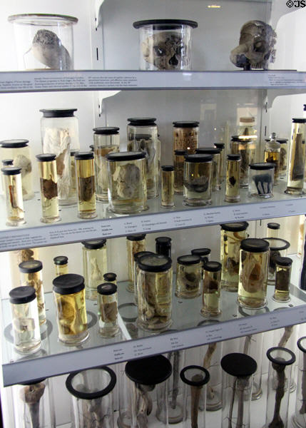 Dr. William Hunter's medical specimens collection at Hunterian Museum. Glasgow, Scotland.